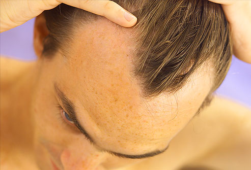 Maschera di senape per capelli senza uovo e olio