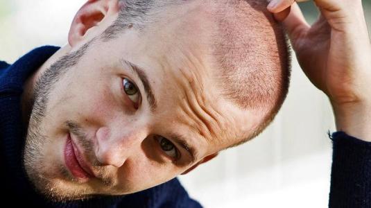 Lo strumento potente per rafforzarsi di capelli