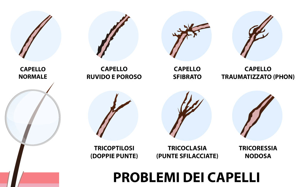 Lei come peso perso che rispondere
