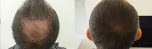 Come applicare correttamente una maschera da kefir su capelli