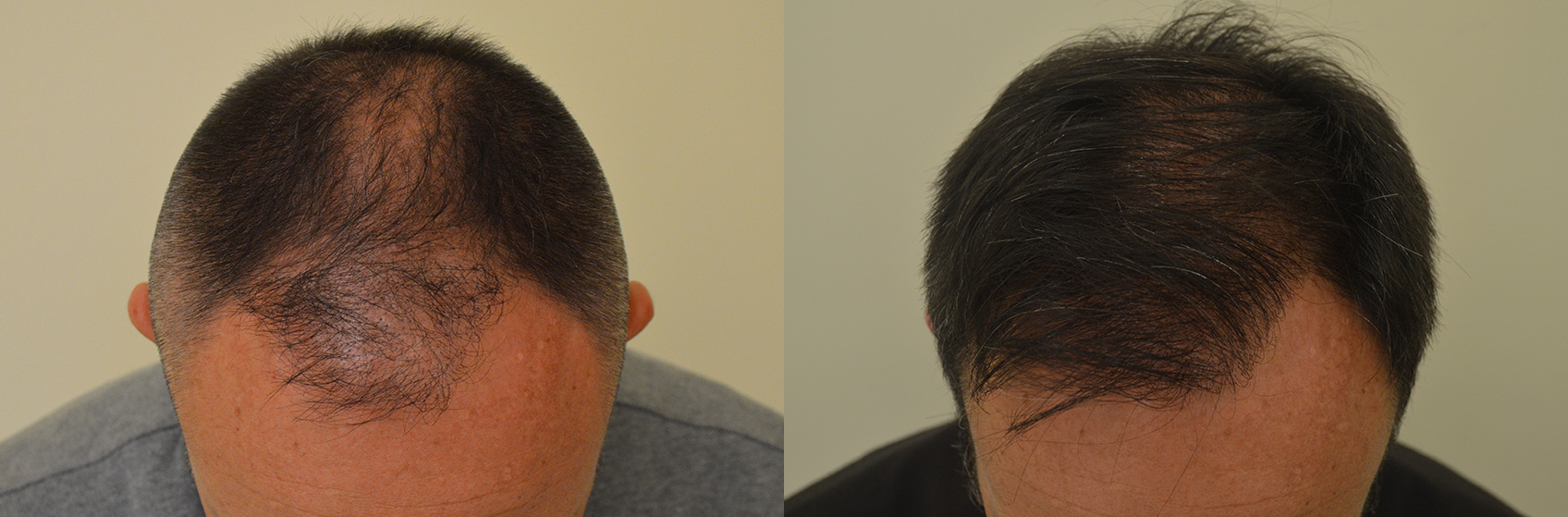Vitamine A e a per capelli e una faccia