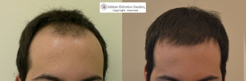 Perfezioni una maschera per capelli