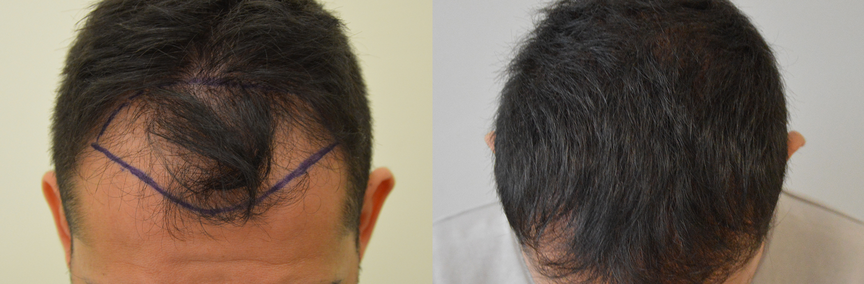 Dopo esser arrossito di capelli quando è possibile mettere una maschera