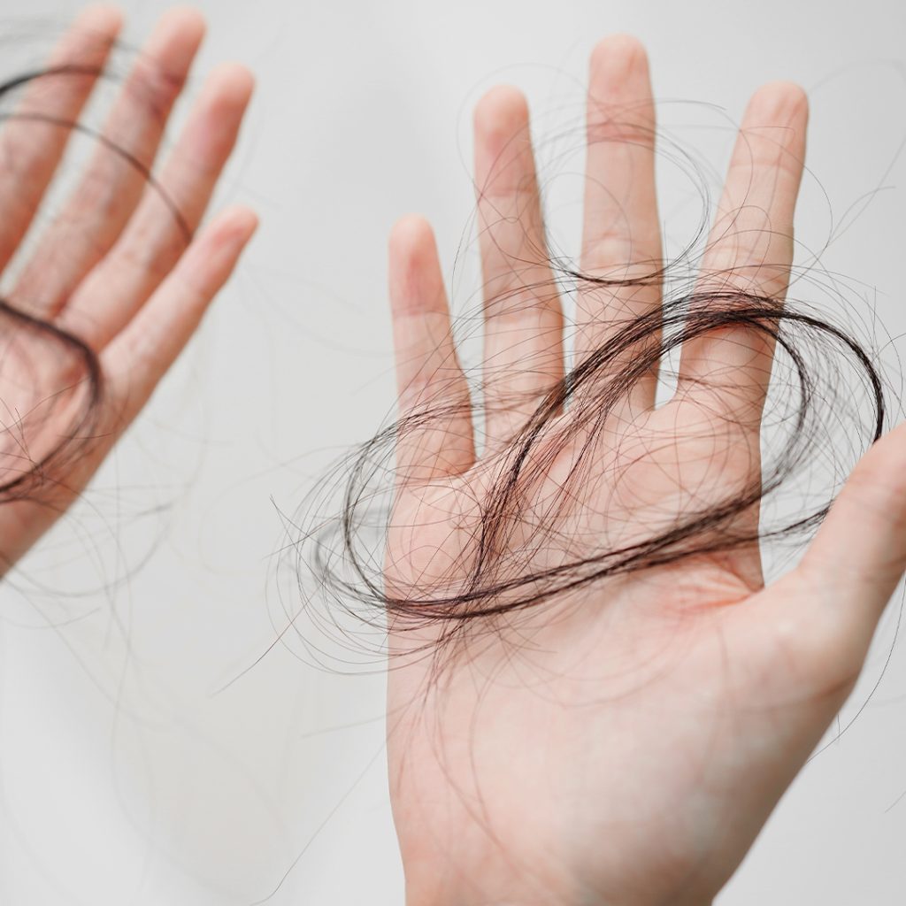 La caduta di capelli in menopausa