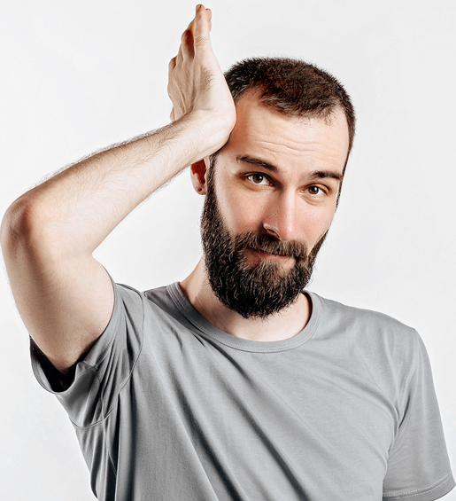 Uomo caduta di capelli da farmaci