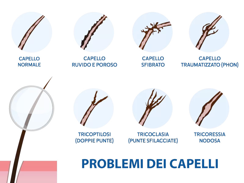 Problemi Capelli