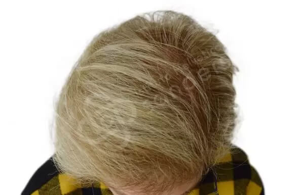 Donatella 65 anni dopo