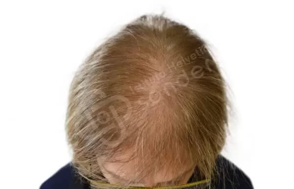 Donatella 65 anni prima