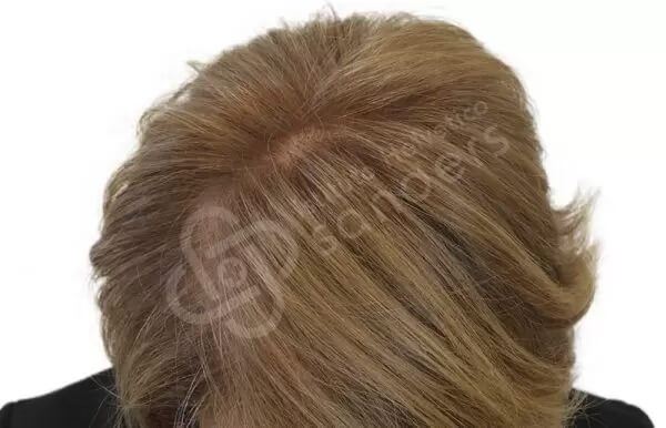 Giovannella 53 anni dopo