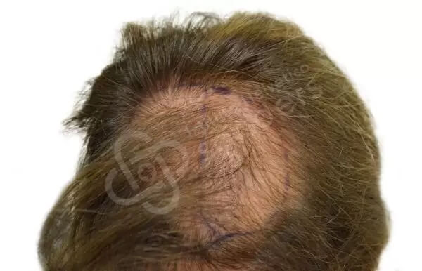 Giovannella 53 anni prima