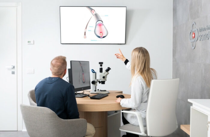 Trapianti Capelli con Protocollo Smart FUE Sanders