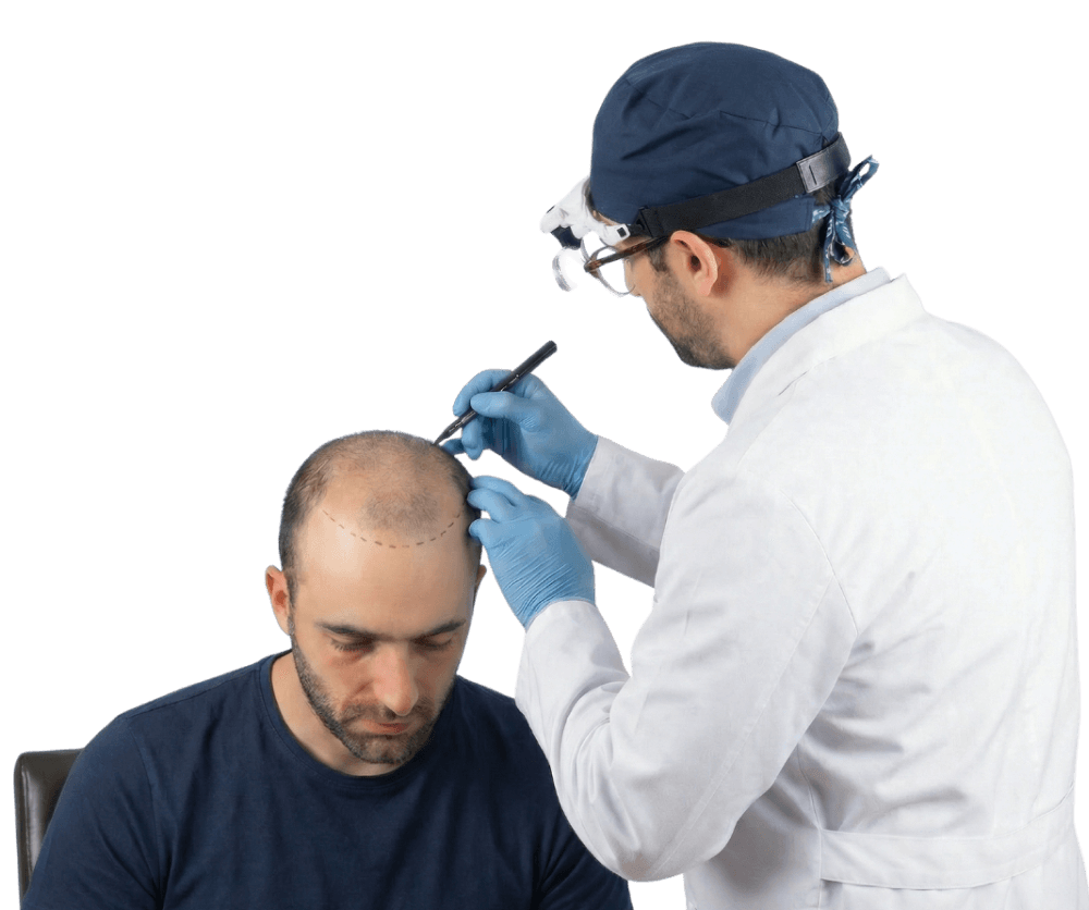 Trapianto di Capelli Sanders