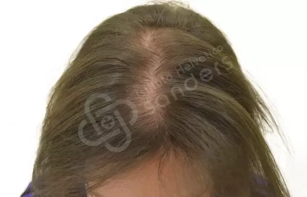 Eleonora 30 anni prima