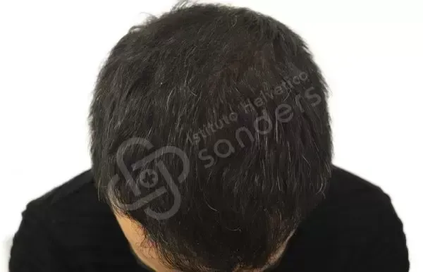 Daniele 37 anni dopo