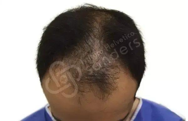 Daniele 37 anni prima