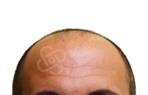 Andrea 46 anni prima