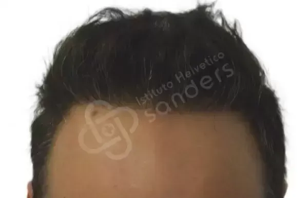 Vincenzo 32 anni dopo