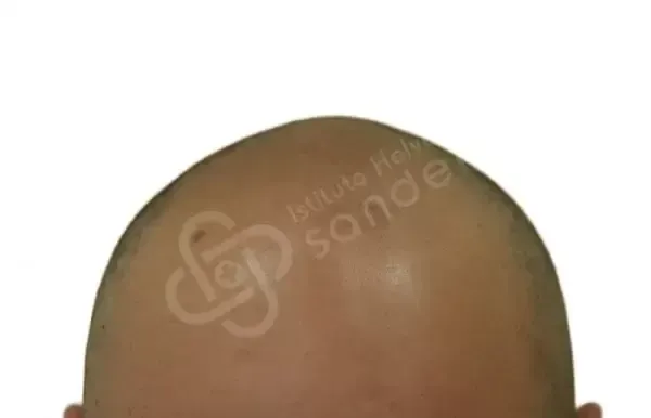 Vincenzo 32 anni prima