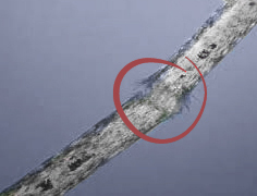 Dettate hawtcelebs Altre anomalie del fusto del capello - Sanders