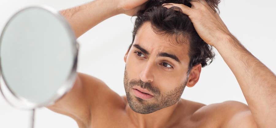 Facial Hair Loss In Men 89