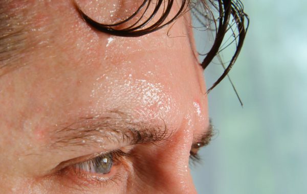 Iperidrosi alla testa quali sono i rimedi