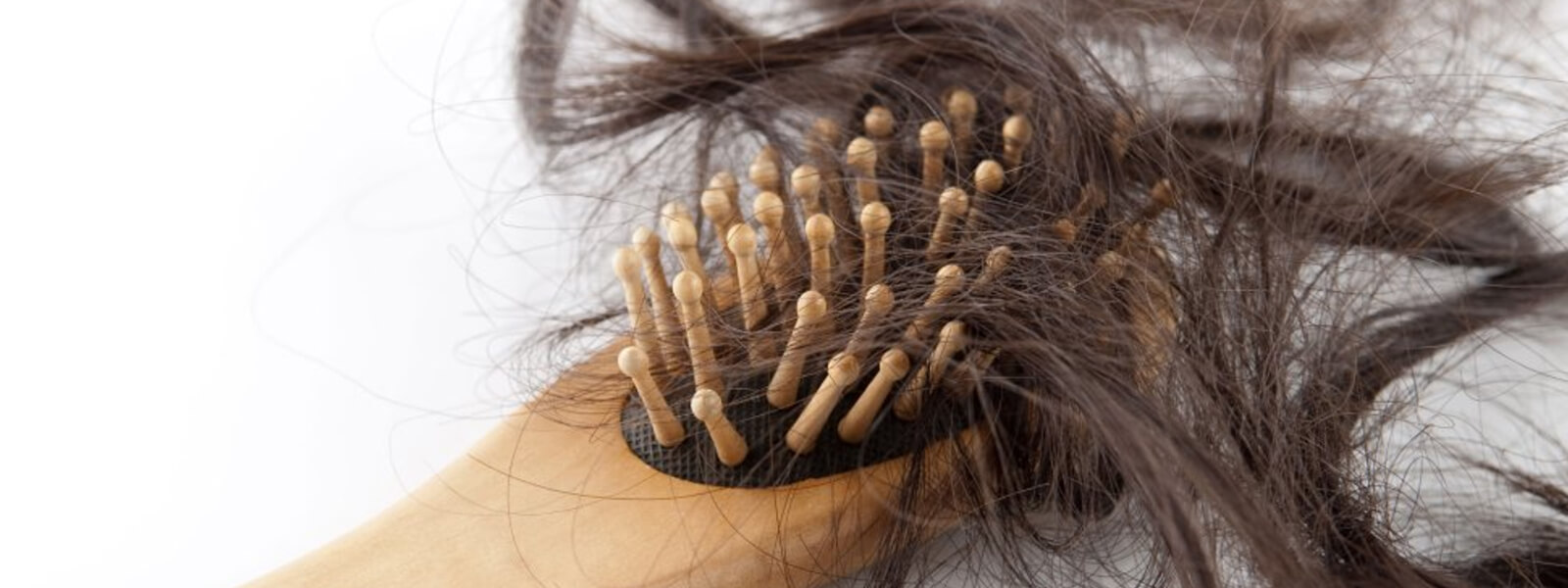 Un'infografica sul fenomeno della caduta capelli donna Un'infografica sul fenomeno della caduta capelli donna