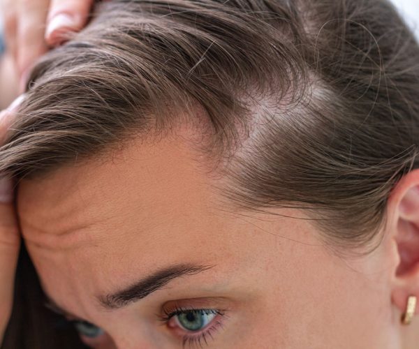 sognare di perdere i capelli