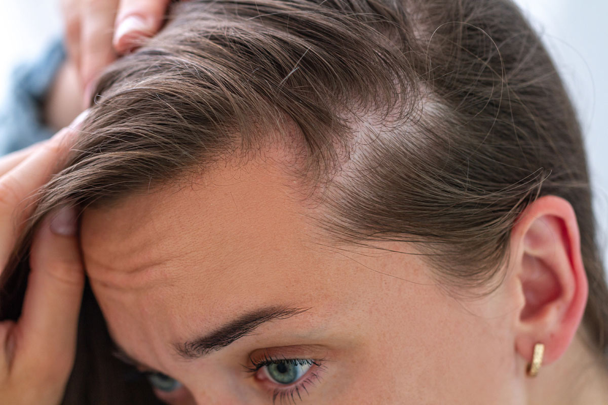 caduta capelli donne gravidanza