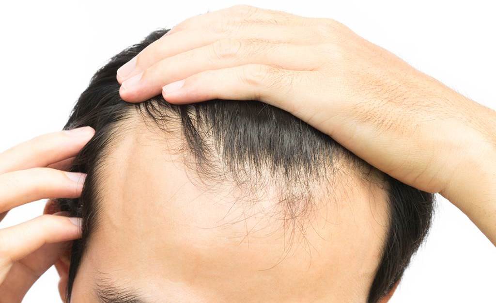 integratori e vitamine funzionano per caduta capelli