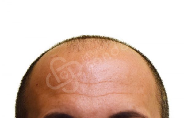 00