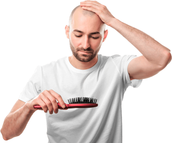 calvizie-maschile-caduta-capelli-uomo