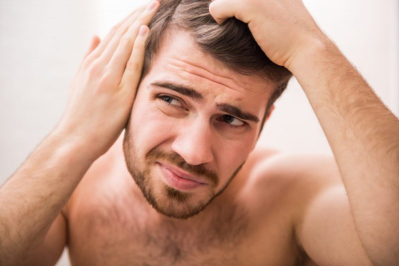 Quanti capelli si perdono al giorno? Istituto Helvetico Sanders