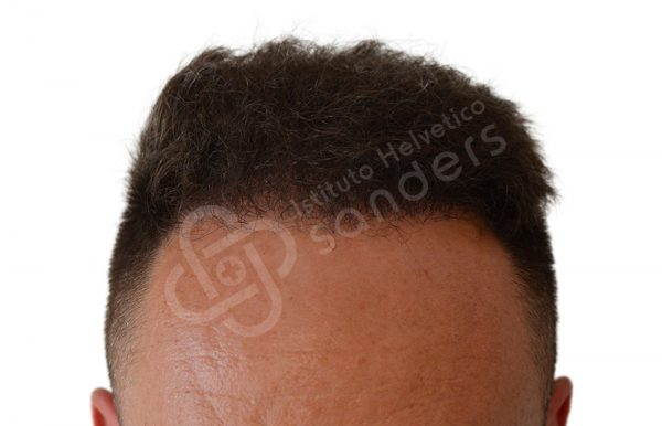 00