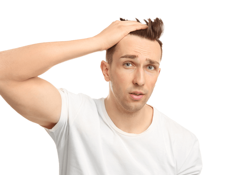 Caduta dei capelli e calvizie: cause, tipologie e rimedi