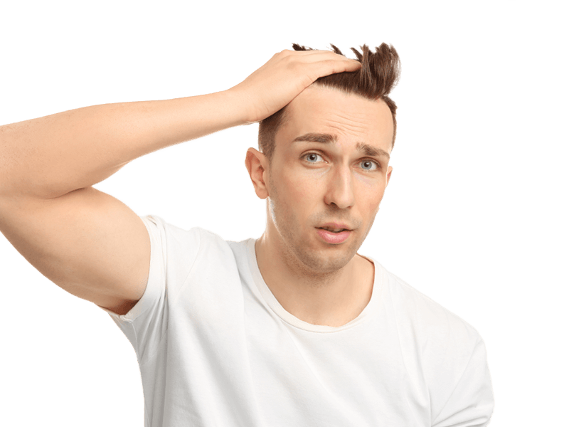 cause-caduta-capelli-calvizie-precoce