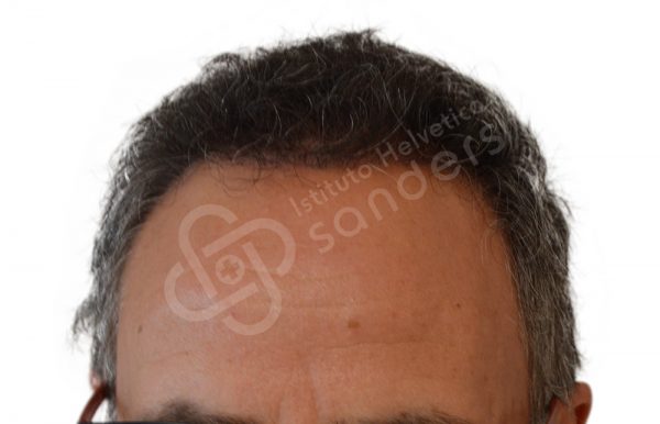 00