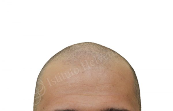00