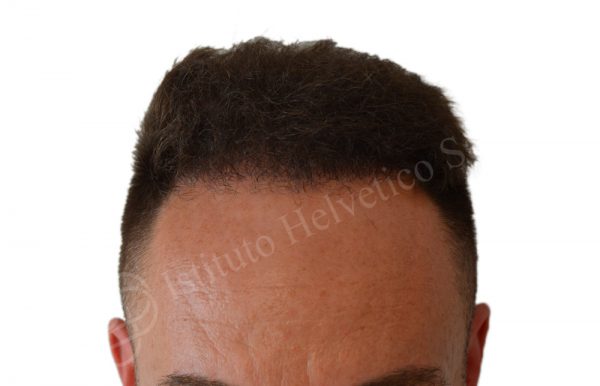 00
