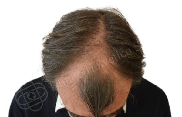 00