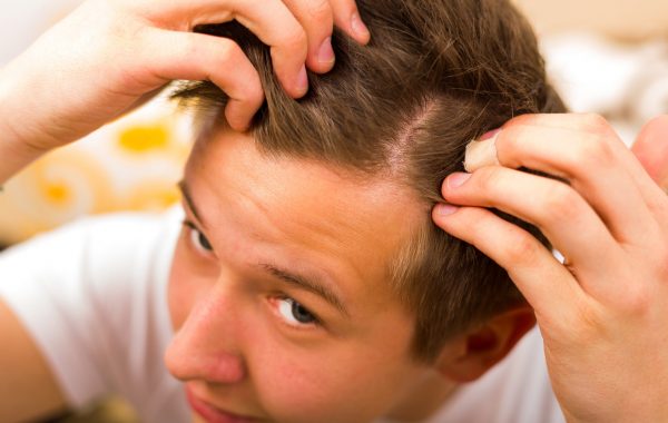 Lozioni anticaduta capelli: come funzionano e quali vengono consigliate