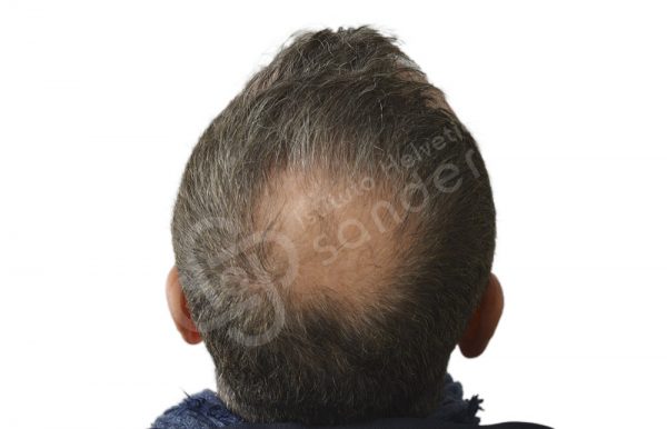 00