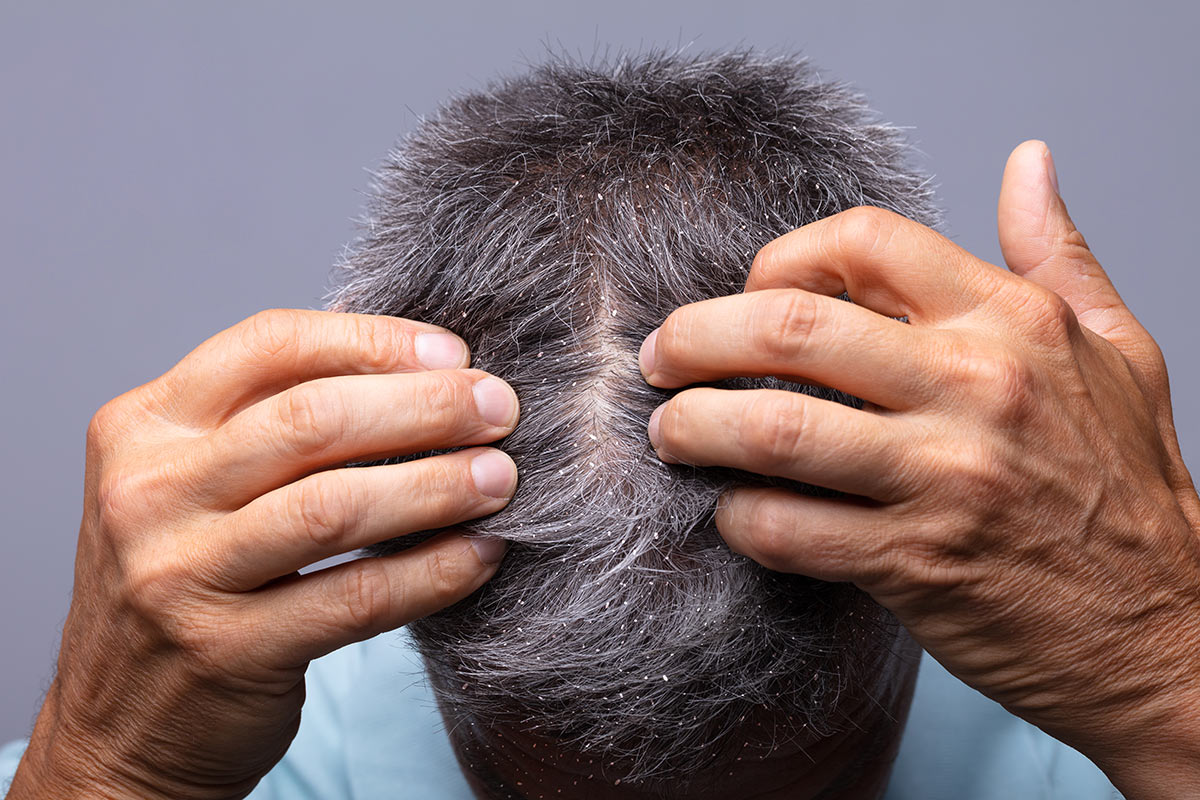 Mantenere i capelli puliti a lungo: ecco le abitudini da evitare