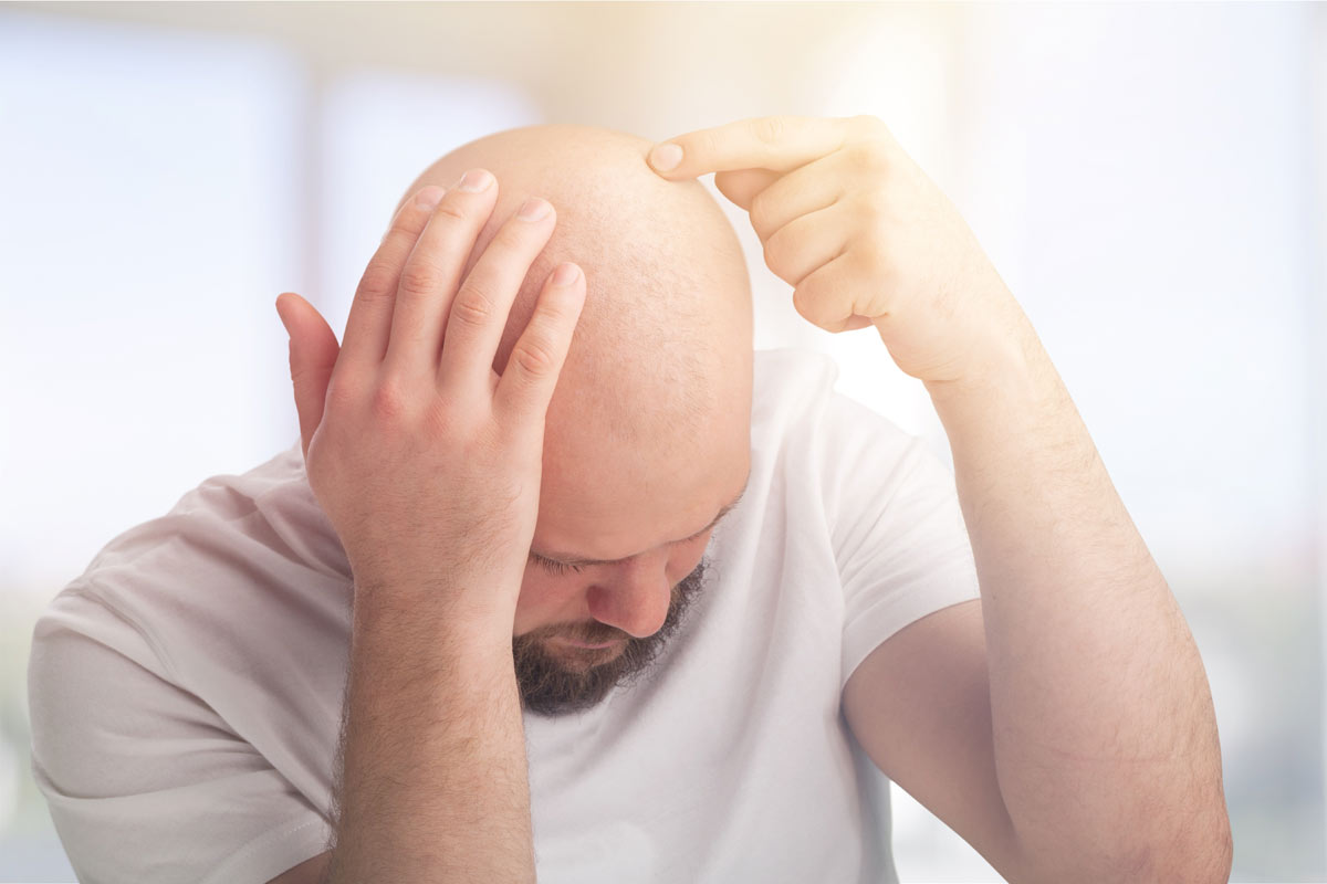 cause alopecia universale