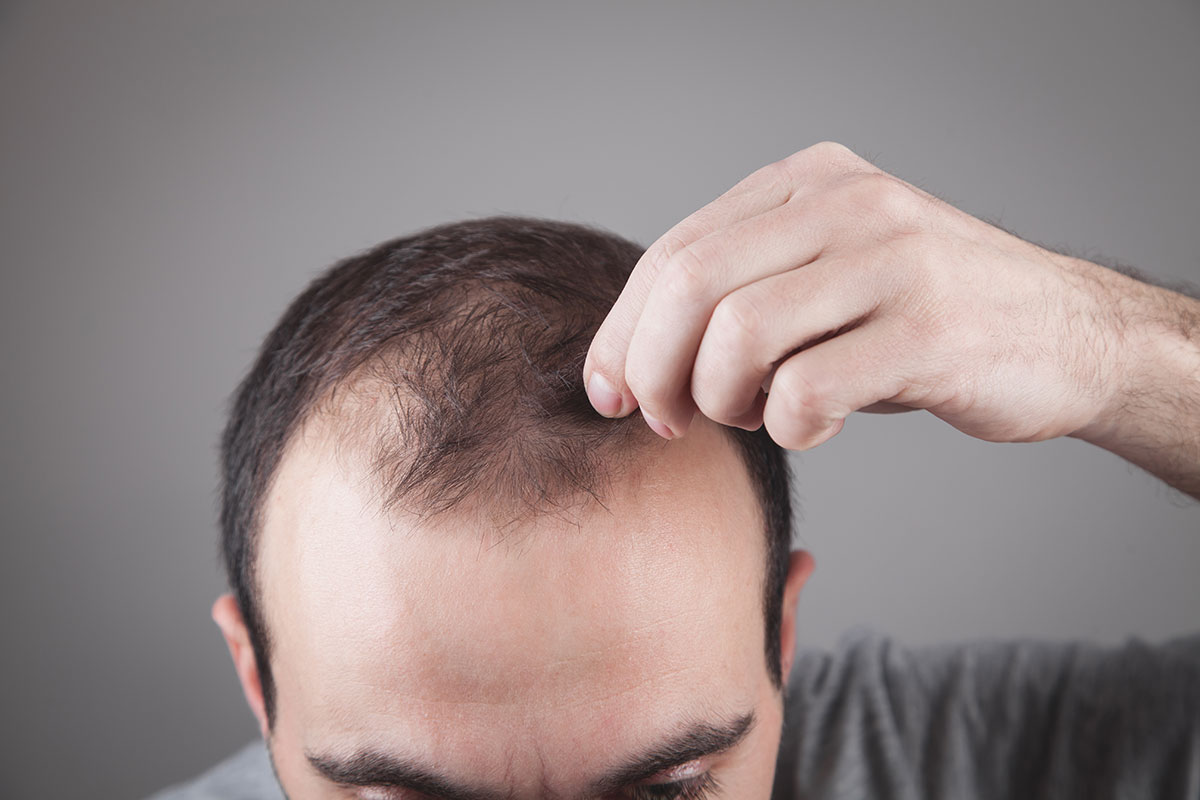come far ricrescere i capelli