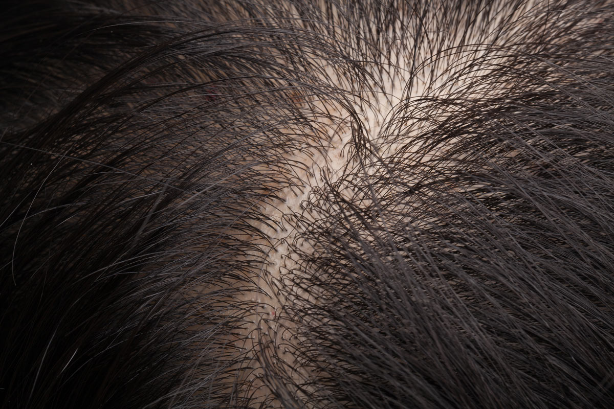 capelli ruvidi