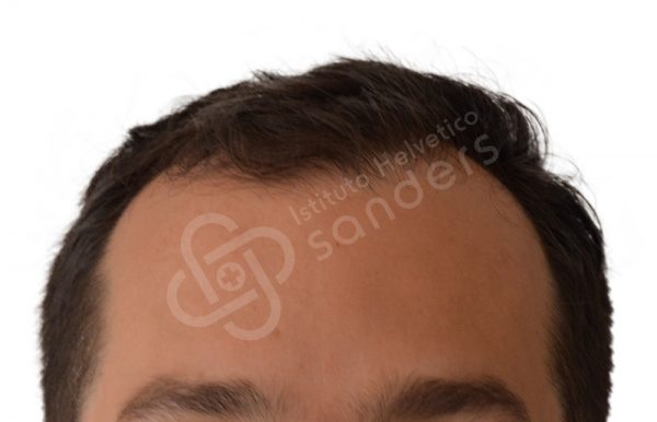 00