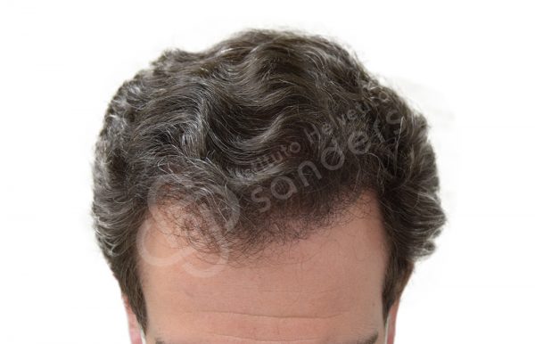 00