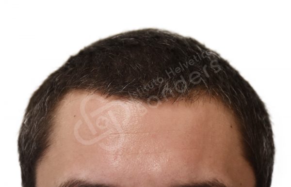 00