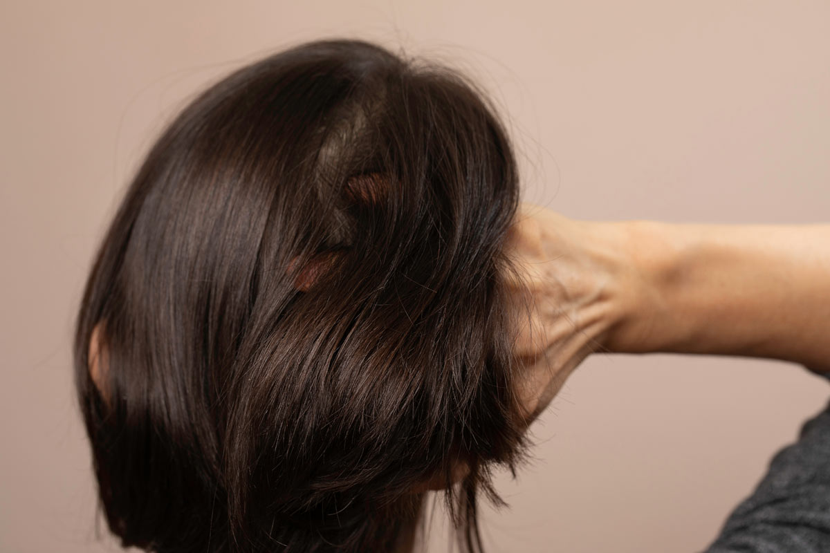 Grattarsi la testa spesso può far male ai capelli?
