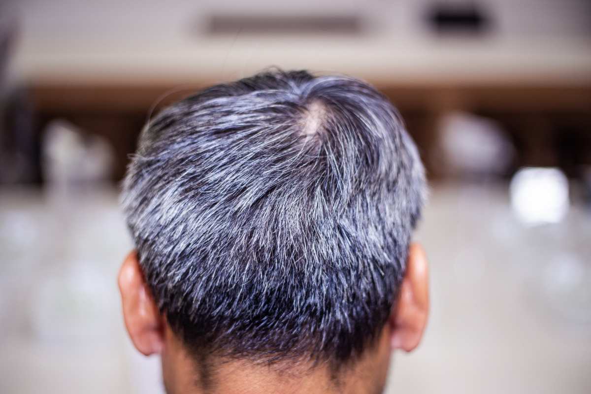chioma capelli